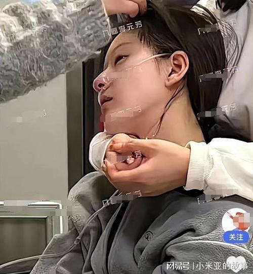 知名女星这个动作火了!男大学生模仿后被紧急送医