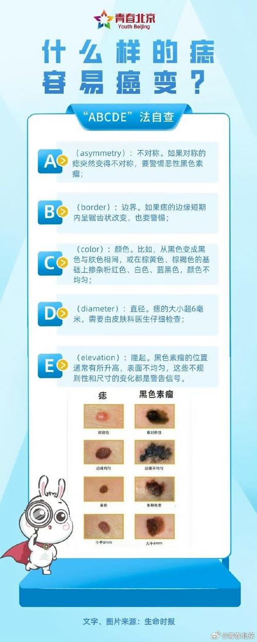 这种痣是癌,医生提醒:这件事要少做!