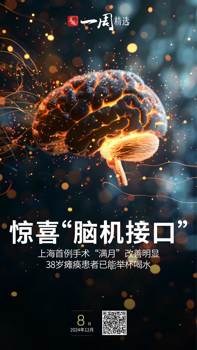 脑机接口新技术让渐冻症患者重新“说话”